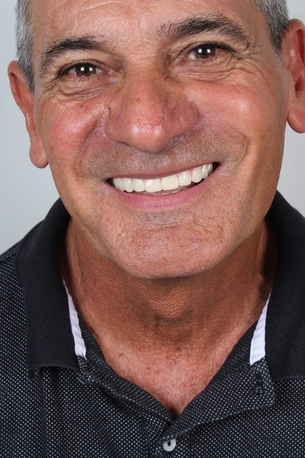 Reabilitação de sorriso