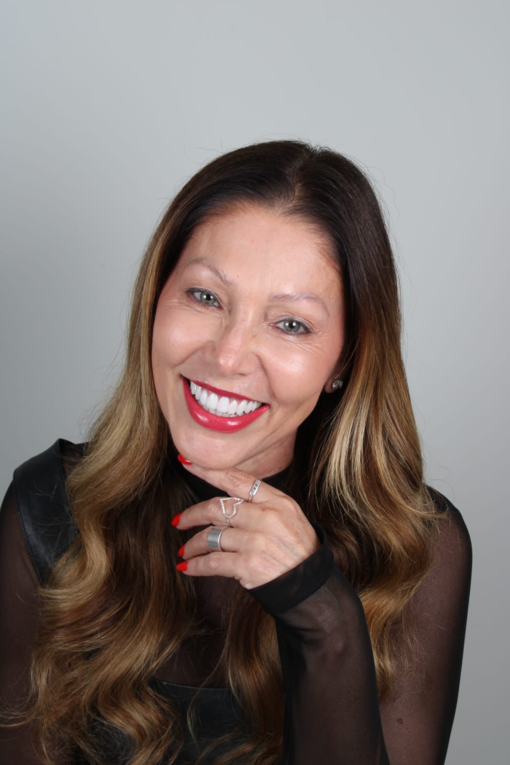 Paciente sorrindo após tratamento estético